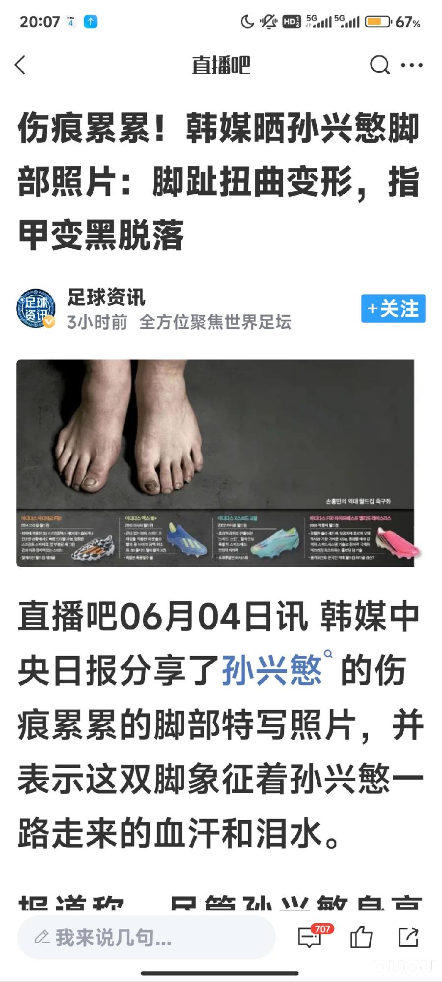 看了孙兴慜的脚,明白了。